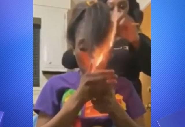 Mulher acende cigarro em momento inusitado e acaba queimando o próprio cabelo; assista